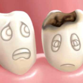 ۱۶ عادتی که دندان های شما را خراب می کند